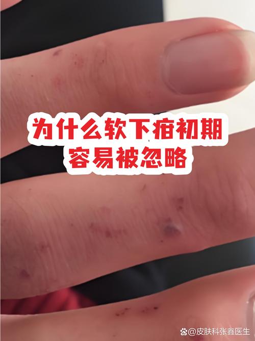 最容易被忽略的“软线索”