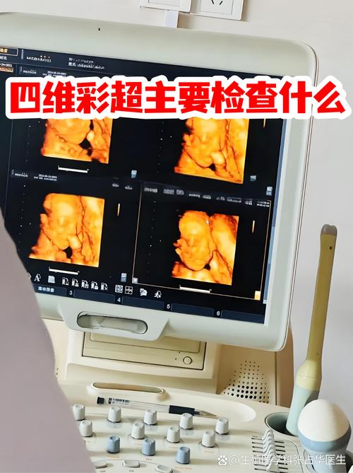 孕妇进行四维彩超检查的画面