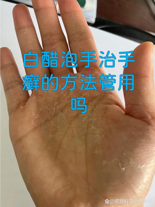 先治好大人的“屏幕粘手症”