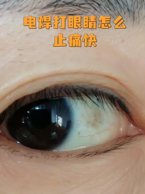验收与避坑：眼睛要毒