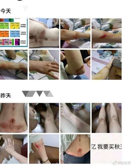 未成年人遭受校园侵害证据留存清单示意图