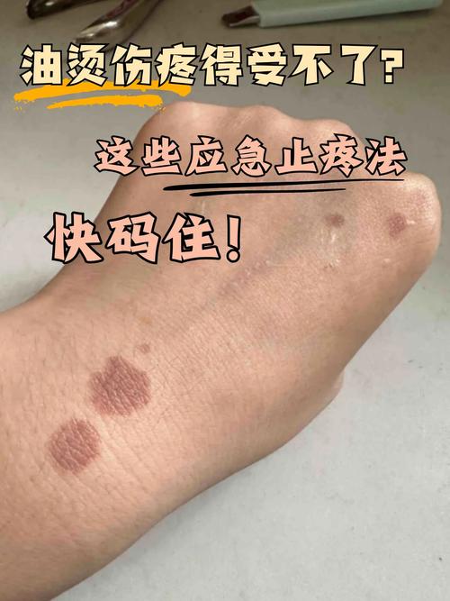 真烫到了，别踩这些救命坑