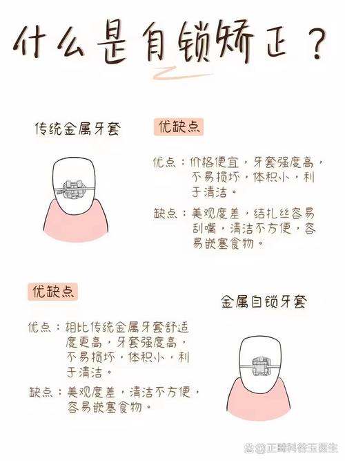 普通人选美观性，直接按这个步骤套就行