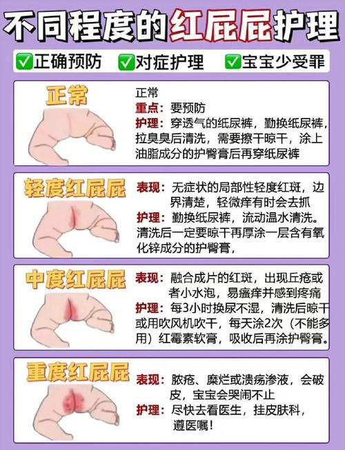 宝宝红屁股护理正确操作示意图