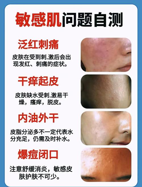 容易忽略的过敏问题，敏感肌要注意