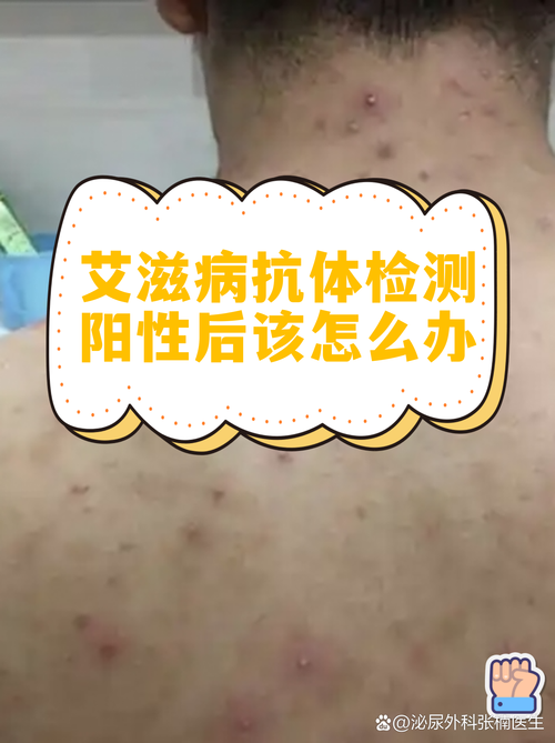 监测完之后该怎么办？