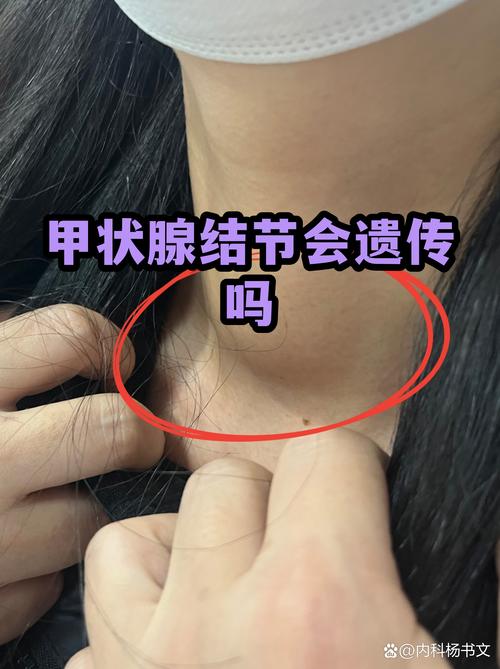 监护相关的常见疑问
