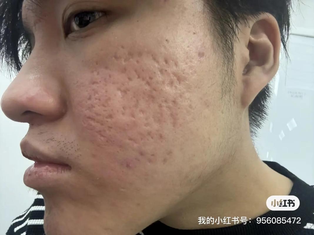 上系统踩过的坑,比老师傅脸上的皱纹还多