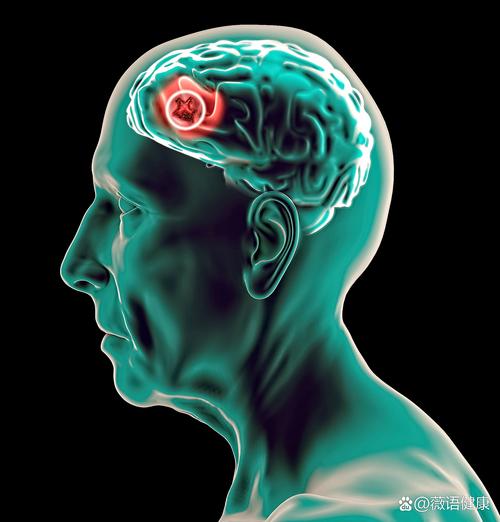 睡眠帮助记忆巩固的大脑扫描图