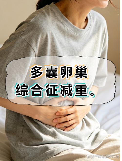 多囊患者3-6个月减重5%-10%获益示意图