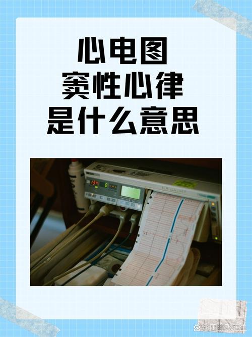 开头一盆冷水:别指望它像医院心电图