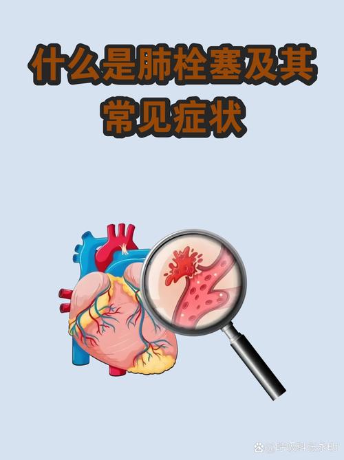 容易被忽略的隐形细节，很多人栽在这