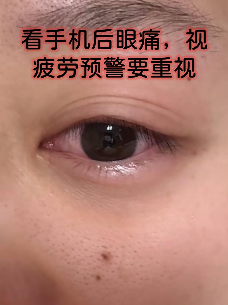 那些被无视的隐形疲劳信号