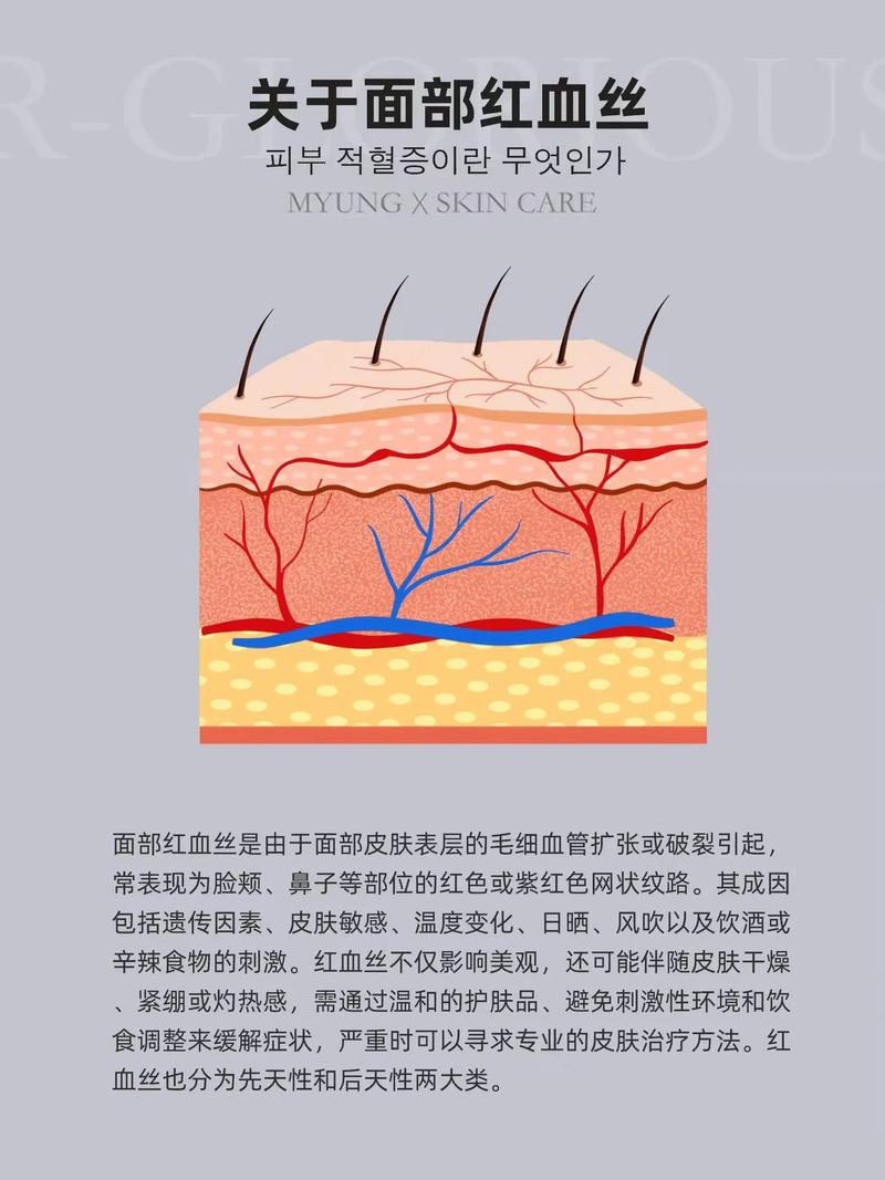 完美主义敏感期的就医危险红线