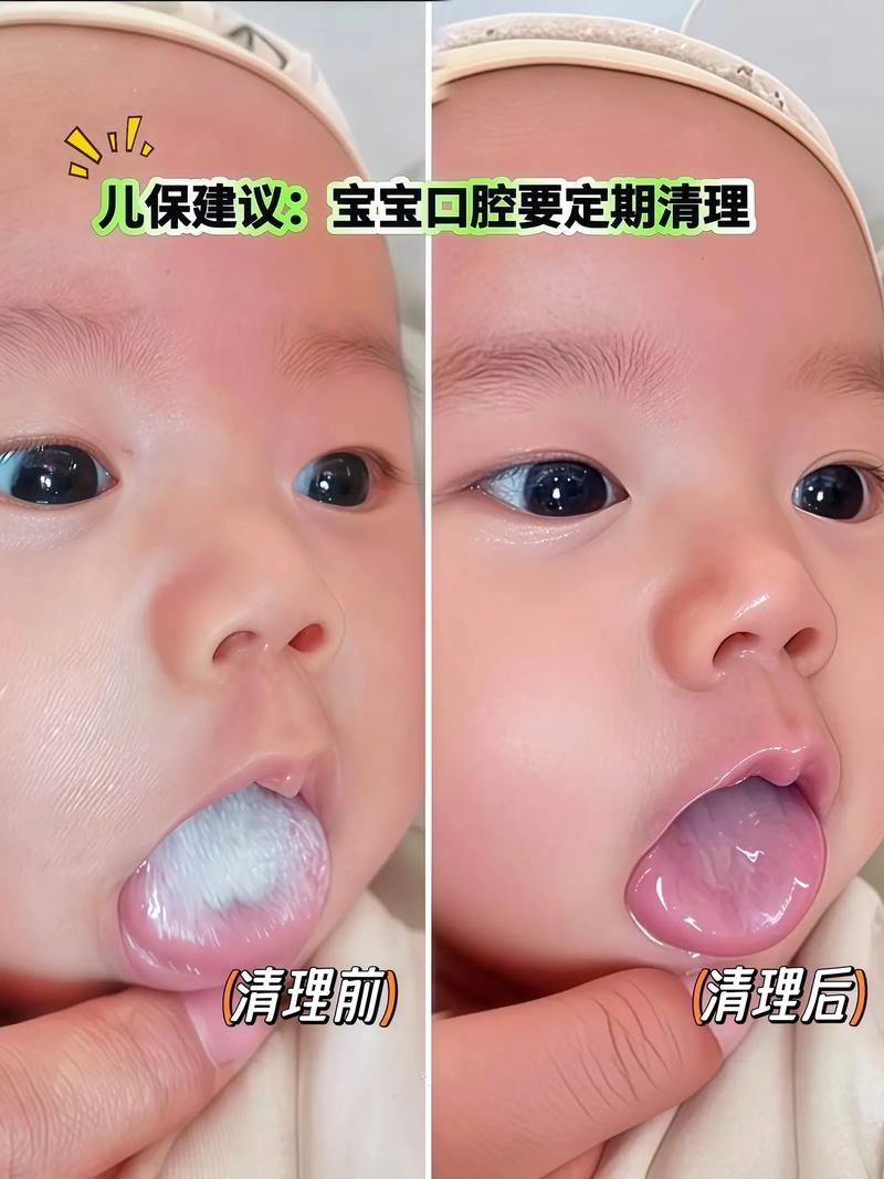 这些宝宝口腔清洁的坑，90%的家长都踩过