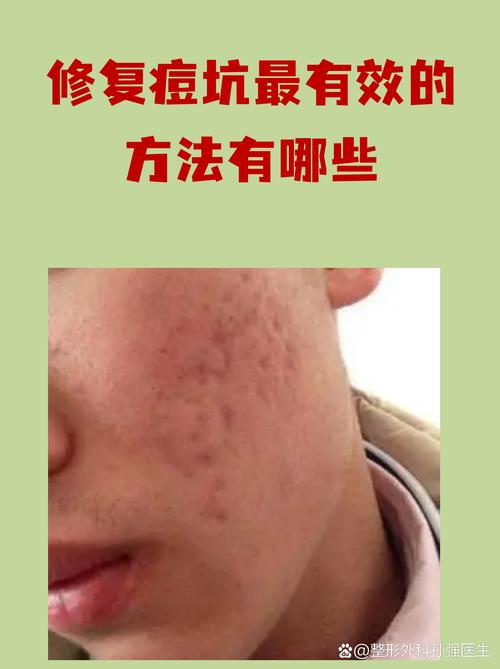 哪些方法有用,哪些是坑