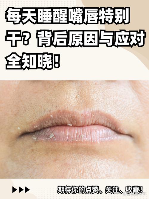 干燥环境下的隐形伤害：眼睛和嘴唇