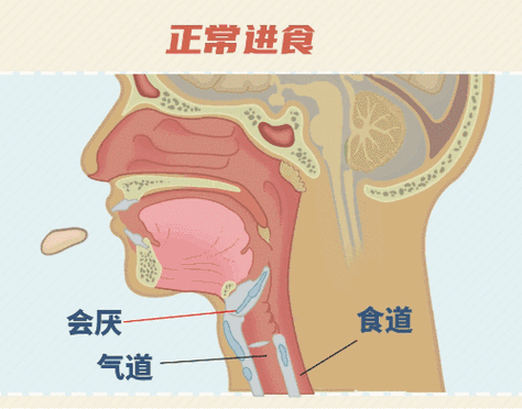 狼吞虎咽进食吞入空气胃部示意图