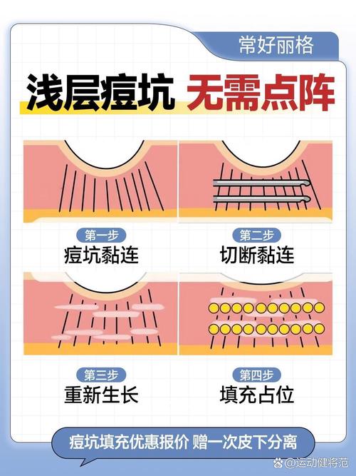 最常见的三个坑