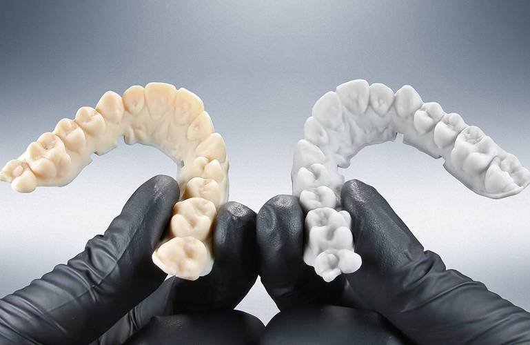 3D打印定制个性化牙冠实物展示