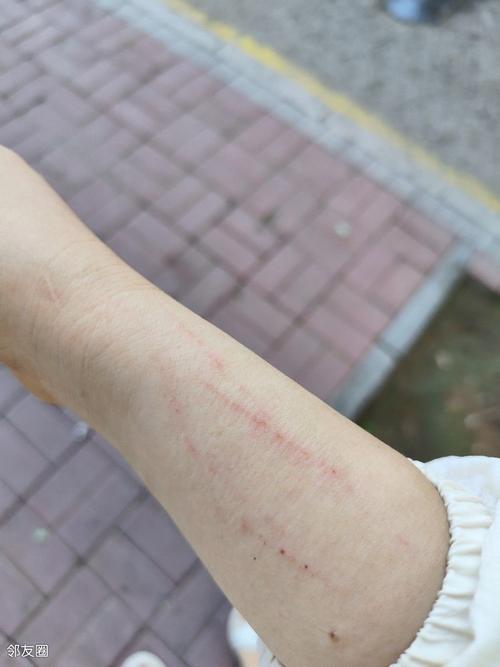 这些伤痕，该留着还是磨掉
