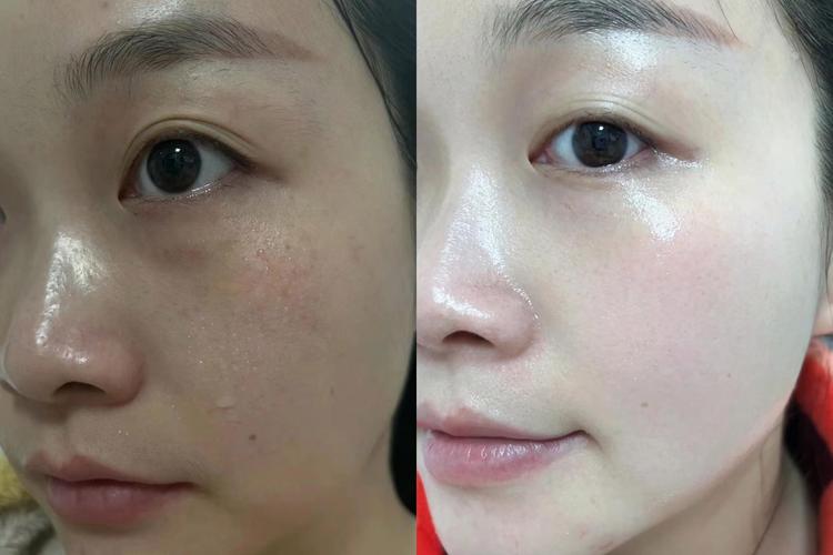 精华叠加使用前后皮肤状态对比图