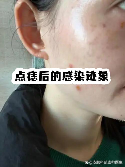 容易被忽略的隐藏坑点