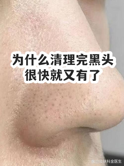 新手妈妈产后在卫生间对着镜子挤黑头的真实居家场景