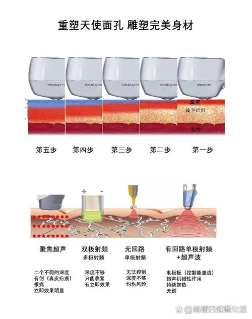 射频美容仪能量穿透皮肤层次图解