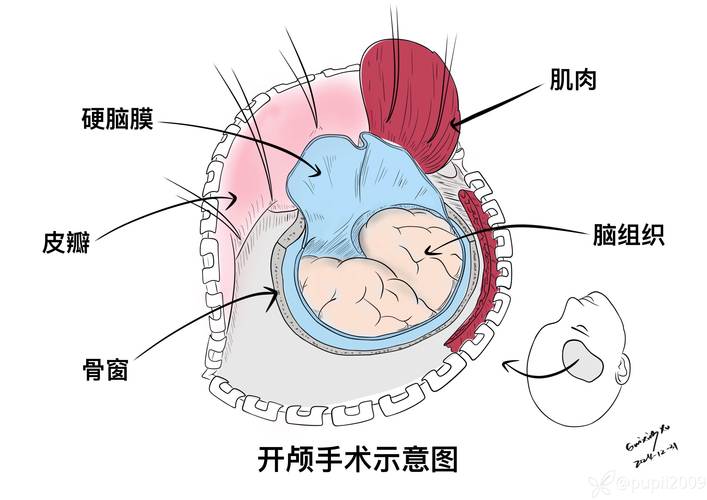 脑机接口技术杂谈：猴子玩游戏是真的，但意识上传纯属扯淡