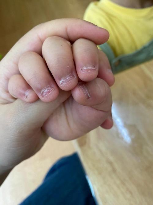小学生考试压力咬指甲特写实拍