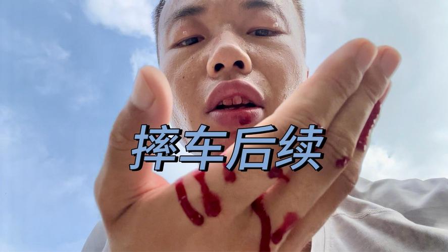 一个螺丝引发的血案