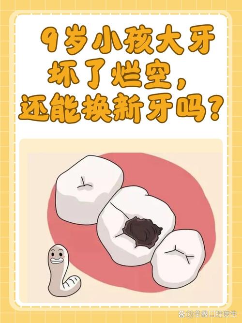 被问烂了的几个常见问题