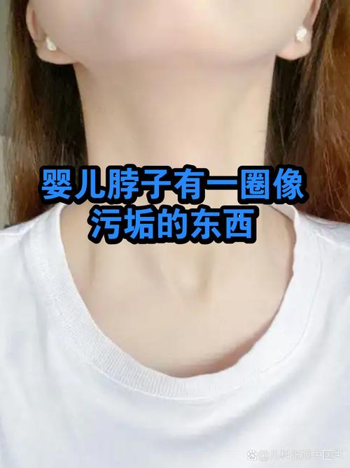 新生儿脖子腋窝褶皱清洁实拍图