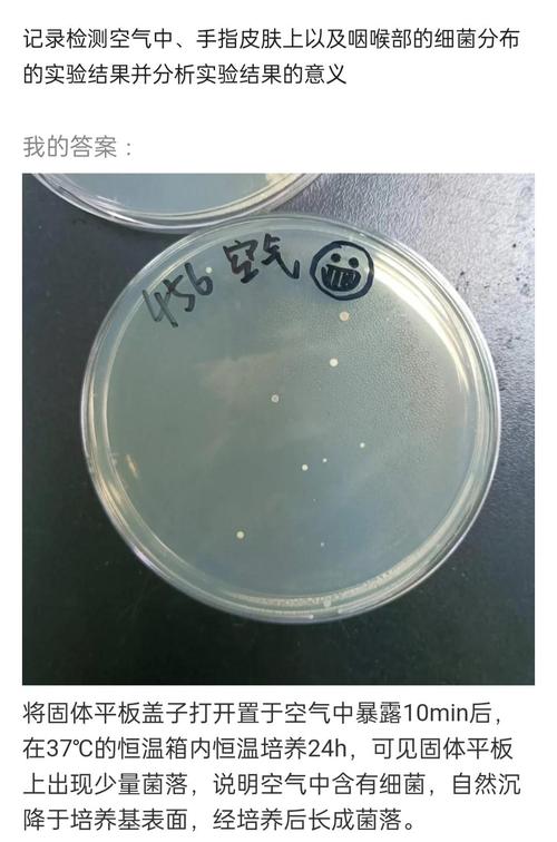 学生观察微生物培养皿真实结果