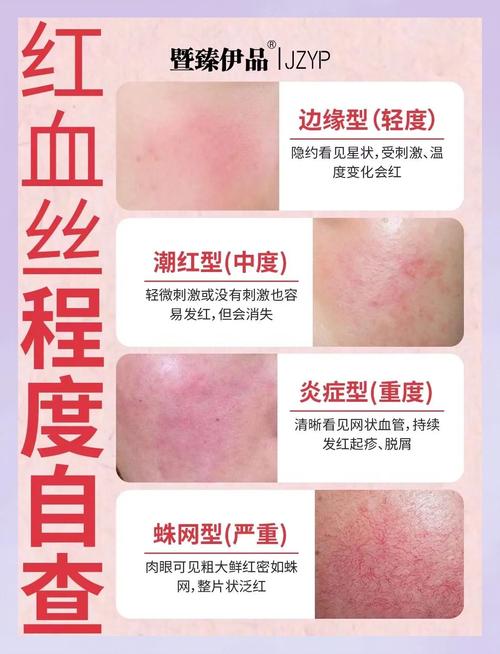 保养血泪:一年后它们都怎么样了?