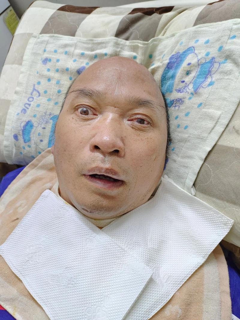 一个让人头疼的真实案例