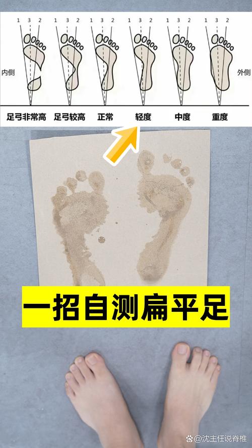 自己就能做的初步判断
