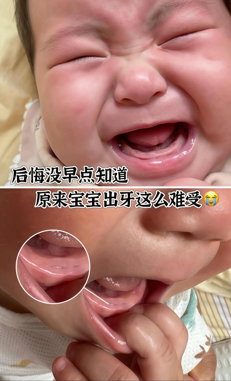 牙齿记录：别再傻傻等牙疼，手把手教你画出宝宝的出牙地图-超级宝贝