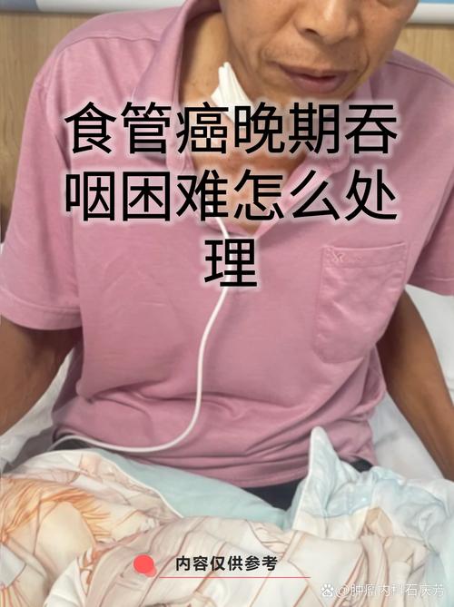 晚期的特殊症状，别当成别的病治