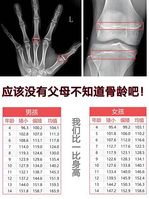 不同年龄关节柔韧度对比参考图