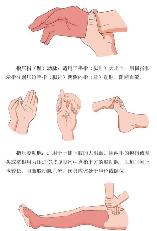 宠物爪部外伤正确按压止血示意图