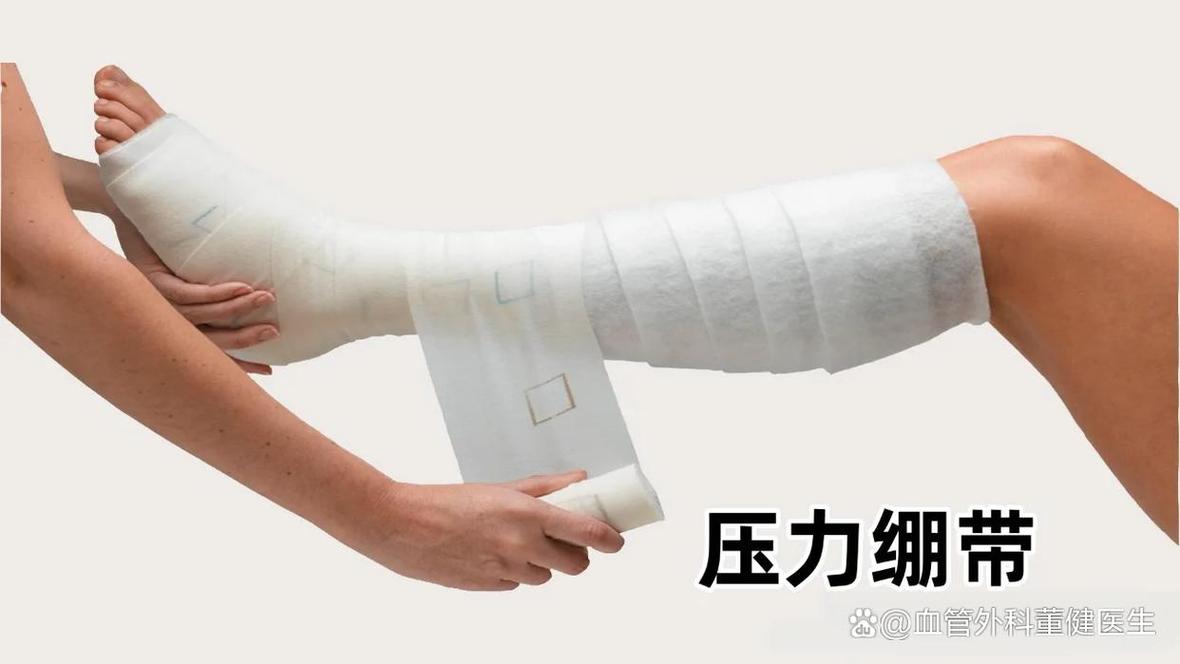 小腿部位弹性绷带加压包扎的合适松紧度实拍