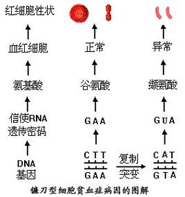 CRISPR基因编辑治疗镰刀型细胞贫血症示意图