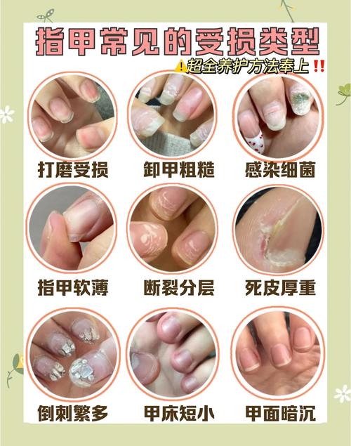 常见伤指甲坏习惯示意图