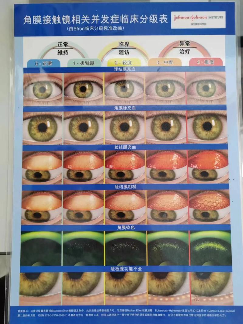 👀 验收与隐患