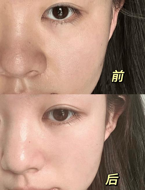 干皮妆前保湿手法对比图