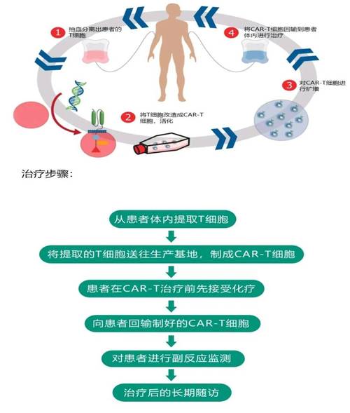 CAR-T免疫疗法生物科技原理示意图