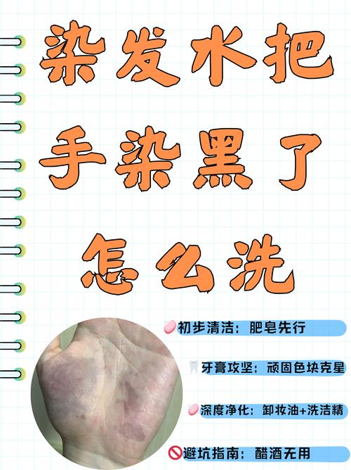 已经发黄发黑了 怎么收拾才稳妥