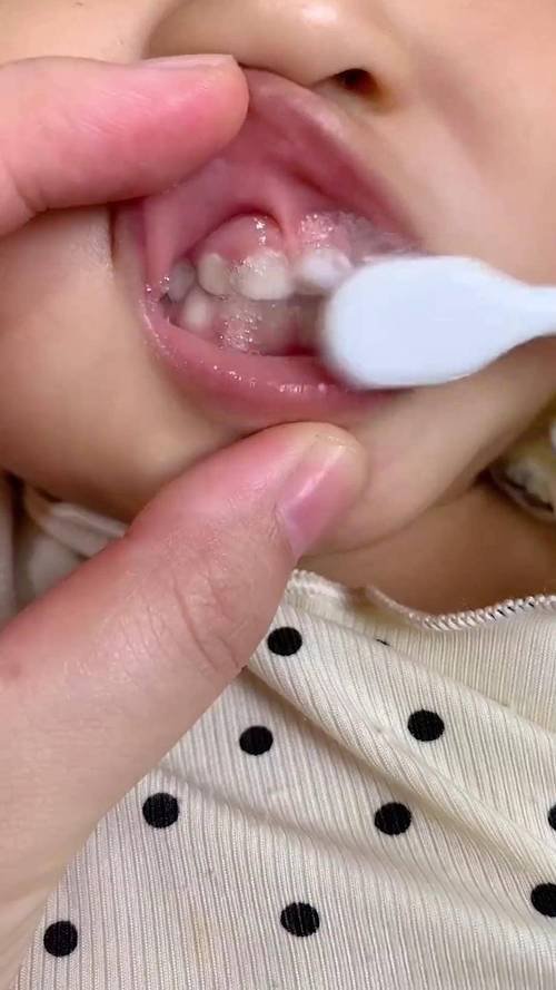 新手妈妈给宝宝清洁出牙牙龈实拍